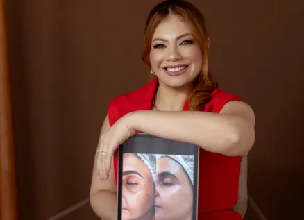 Patricia Carvalho, criadora do Desafio Melasma Nunca Mais