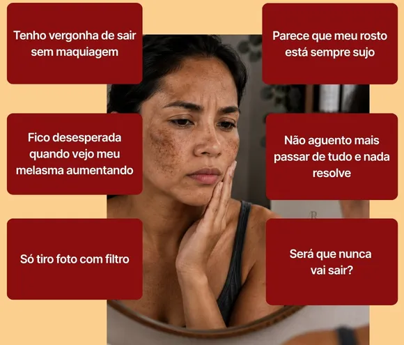 Mulher preocupada diante do espelho, cercada por frases: tenho vergonha de sair sem maquiagem; parece que meu rosto está sempre sujo; fico desesperada quando vejo meu melasma aumentando; não aguento mais passar de tudo e nada resolve; só tiro foto com filtro; será que nunca vai sair?